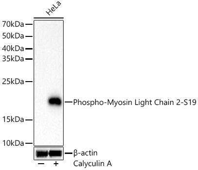 Western Blot: MYL9 [p Ser19] Antibody (6D8B7) [NBP3-33577] - Western blot analysis of lysates from HeLa cells, using MYL9 Rabbit mAb at 1:1000 dilution. HeLa cells were treated by Calyculin A (100 nM) at 37C for 30 minutes after serum-starvation overnight.Secondary antibody: HRP-conjugated Goat anti-Rabbit IgG (H+L) at 1:10000 dilution.Lysates/proteins: 25ug per lane.Blocking buffer: 3% nonfat dry milk in TBST.Detection: ECL Basic Kit.Exposure time: 10s.