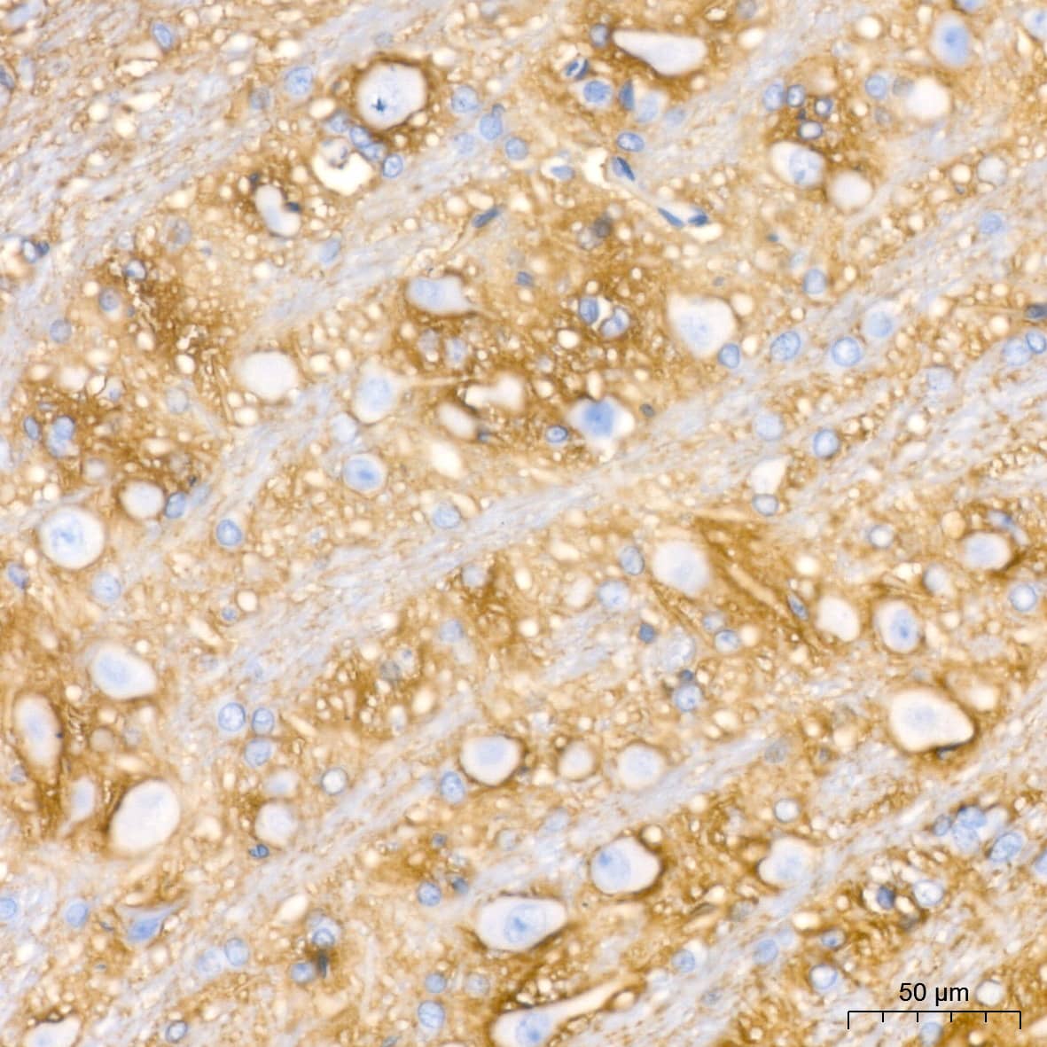 Immunohistochemistry: Aquaporin-4 Antibody (5A4W4) [NBP3-35055] - Immunohistochemistry analysis of paraffin-embedded Rat brain tissue using Aquaporin-4 Rabbit mAb at a dilution of 1:200 (40x lens). High pressure antigen retrieval performed with 0.01M Citrate Bufferr (pH 6.0) prior to IHC staining.