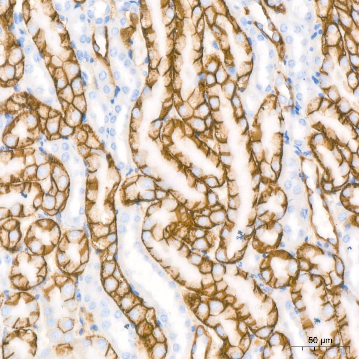 Immunohistochemistry: Aquaporin-4 Antibody (5A4W4) [NBP3-35055] - Immunohistochemistry analysis of paraffin-embedded Mouse kidney tissue using Aquaporin-4 Rabbit mAb at a dilution of 1:200 (40x lens). High pressure antigen retrieval performed with 0.01M Citrate Bufferr (pH 6.0) prior to IHC staining.