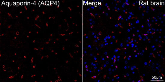 Immunocytochemistry/ Immunofluorescence: Aquaporin-4 Antibody (5A4W4) [NBP3-35055] - Confocal imaging of paraffin-embedded rat brain tissue using Aquaporin-4 Rabbit mAb followed by a further incubation with Cy3 Goat Anti-Rabbit IgG (H+L) (Red). DAPI was used for nuclear staining (Blue). Objective: 40x.Perform microwave antigen retrieval with 0.01M citrate buffer (pH 6.0) prior to IF staining.