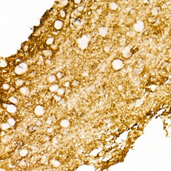 Immunohistochemistry: Aquaporin-4 Antibody (5A4W4) [NBP3-35055] - Immunohistochemistry analysis of paraffin-embedded Mouse brain tissue using Aquaporin-4Rabbit mAb at a dilution of 1:200 (40x lens). High pressure antigen retrieval performed with 0.01M Citrate Bufferr (pH 6.0) prior to IHC staining.