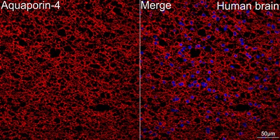 Immunohistochemistry: Aquaporin-4 Antibody (5A4W4) [NBP3-35055] - Immunohistochemistry analysis of paraffin-embedded Mouse liver tissue using Aquaporin-4Rabbit mAb at a dilution of 1:200 (40x lens). High pressure antigen retrieval performed with 0.01M Citrate Bufferr (pH 6.0) prior to IHC staining.