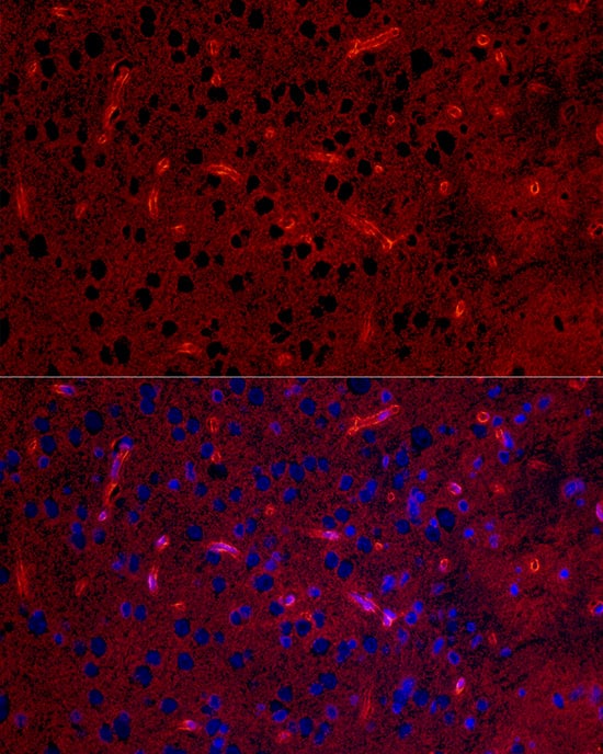 Immunohistochemistry: Aquaporin-4 Antibody (5A4W4) [NBP3-35055] - Immunohistochemistry analysis of paraffin-embedded Mouse lung tissue using Aquaporin-4Rabbit mAb at a dilution of 1:200 (40x lens). High pressure antigen retrieval performed with 0.01M Citrate Bufferr (pH 6.0) prior to IHC staining.