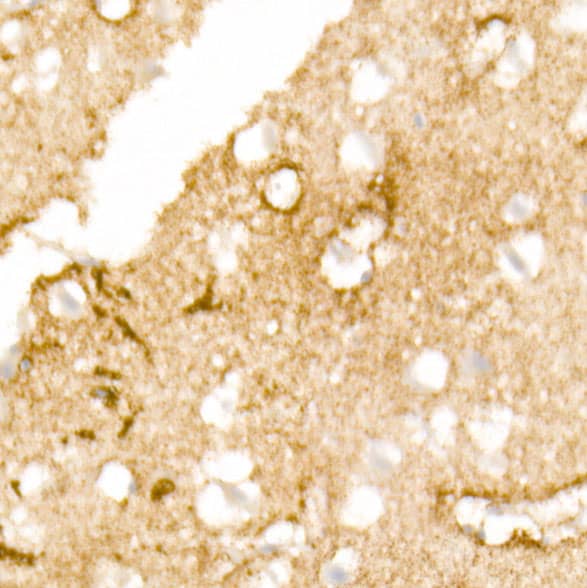 Immunohistochemistry Aquaporin-4 Antibody (5A4W4)