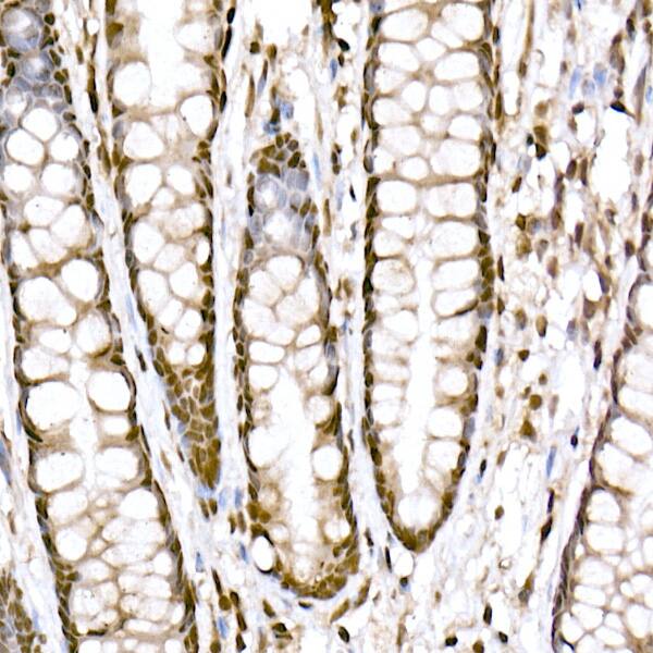 Immunohistochemistry PRDM9 Antibody (1H9Z1)