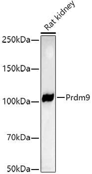 Western Blot PRDM9 Antibody (1H9Z1)