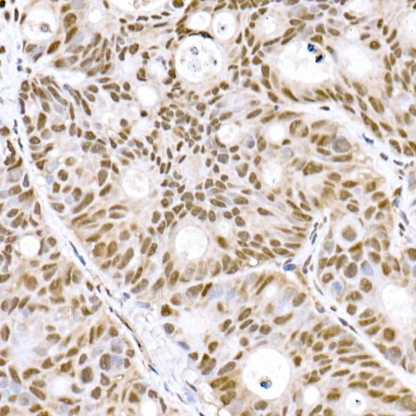 Immunohistochemistry PRDM9 Antibody (1H9Z1)