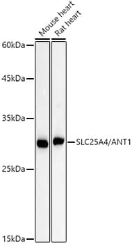 Western Blot: Adenine Nucleotide Translocase 1 Antibody (3C1Q3) [NBP3-35061] - Western blot analysis of various lysates using [KO Validated] Adenine Nucleotide Translocase 1 Rabbit mAb at1:1000 dilution.Secondary antibody: HRP-conjugated Goat anti-Rabbit IgG (H+L) at1:10000 dilution.Lysates/proteins: 25ug per lane.Blocking buffer: 3% nonfat dry milk in TBST.Detection: ECL Basic Kit.Exposure time: 60s.