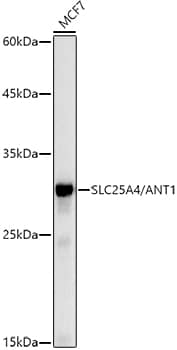 Western Blot: Adenine Nucleotide Translocase 1 Antibody (3C1Q3) [NBP3-35061] - Western blot analysis of lysates from MCF7 cells, using [KO Validated] Adenine Nucleotide Translocase 1 Rabbit mAb at1:1000 dilution.Secondary antibody: HRP-conjugated Goat anti-Rabbit IgG (H+L) at1:10000 dilution.Lysates/proteins: 25ug per lane.Blocking buffer: 3% nonfat dry milk in TBST.Detection: ECL Basic Kit.Exposure time: 10s.