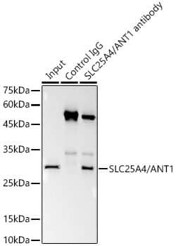 Immunoprecipitation: Adenine Nucleotide Translocase 1 Antibody (3C1Q3) [NBP3-35061] - Immunoprecipitation analysis of 300 ug extracts of 293T cells using 3 ug Adenine Nucleotide Translocase 1 antibody. Western blot was performed from the immunoprecipitate using Adenine Nucleotide Translocase 1 antibody at a dilution of 1:1000.