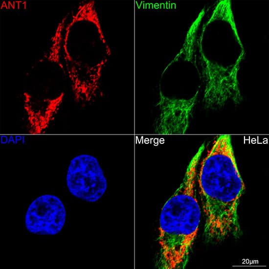 <b>Genetic Strategies Validation. </b>Knockout Validated: Adenine Nucleotide Translocase 1 Antibody (3C1Q3) [NBP3-35061] - Confocal imaging of HeLa cells using [KO Validated] SLC25A4/ANT1 Rabbit mAb. The cells were counterstained with [KO Validated] Vimentin Rabbit mAb (Green). DAPI was used for nuclear staining (blue). Objective: 60x.