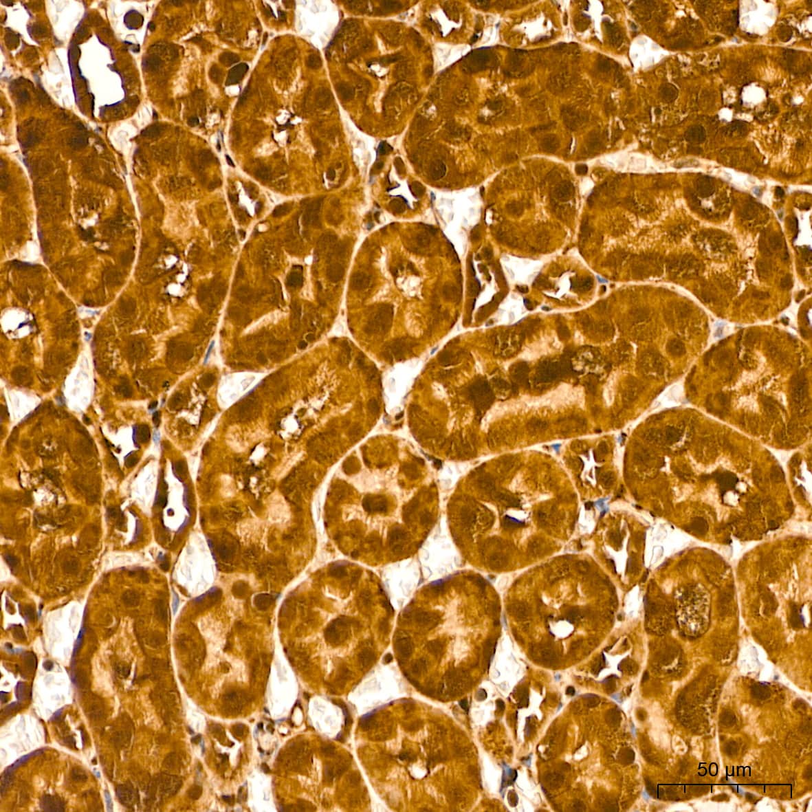 Immunohistochemistry: ERK1/2 Antibody (2Z8O1) [NBP3-35062] - Immunohistochemistry analysis of paraffin-embedded Rat kidney tissue using ERK1/2 Rabbit mAb at a dilution of 1:200 (40x lens). High pressure antigen retrieval performed with 0.01M Citrate Bufferr (pH 6.0) prior to IHC staining.