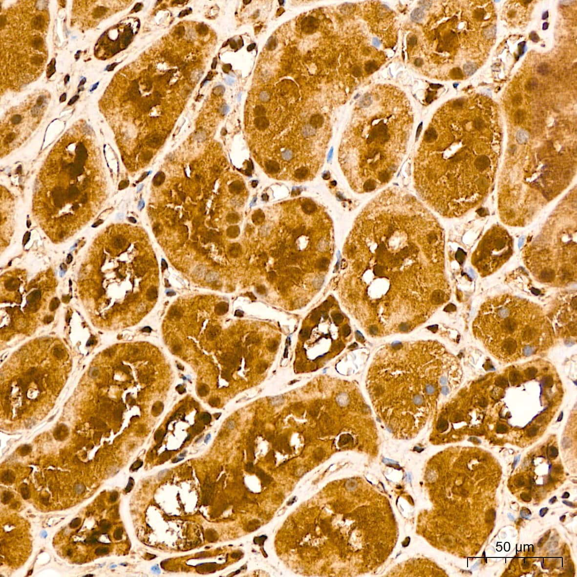 Immunohistochemistry: ERK1/2 Antibody (2Z8O1) [NBP3-35062] - Immunohistochemistry analysis of paraffin-embedded Human kidney tissue using ERK1/2 Rabbit mAb at a dilution of 1:200 (40x lens). High pressure antigen retrieval performed with 0.01M Citrate Bufferr (pH 6.0) prior to IHC staining.