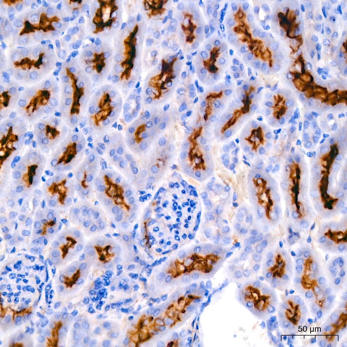 Immunohistochemistry: ERK1/2 Antibody (2Z8O1) [NBP3-35062] - Immunohistochemistry analysis of paraffin-embedded Rat kidney tissue using ERK1/2 Rabbit mAb at a dilution of 1:200 (40x lens). High pressure antigen retrieval performed with 0.01M Citrate Bufferr (pH 6.0) prior to IHC staining.