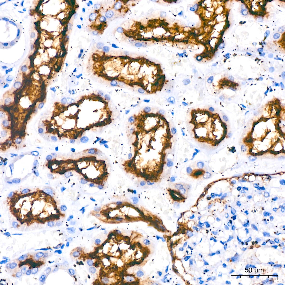 Immunohistochemistry: ERK1/2 Antibody (2Z8O1) [NBP3-35062] - Immunohistochemistry analysis of paraffin-embedded Human kidney tissue using ERK1/2 Rabbit mAb at a dilution of 1:200 (40x lens). High pressure antigen retrieval performed with 0.01M Citrate Bufferr (pH 6.0) prior to IHC staining.