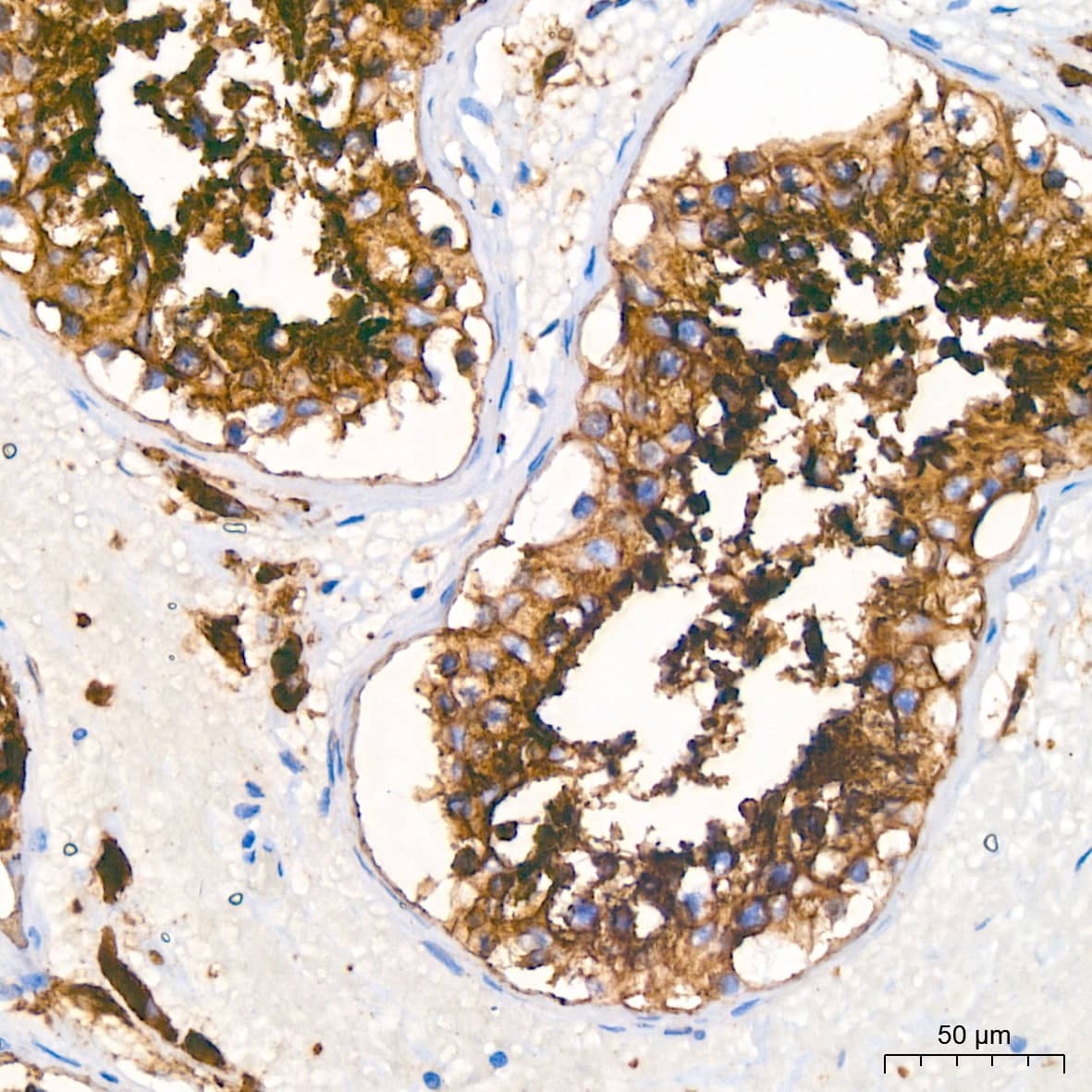 Immunohistochemistry: ERK1/2 Antibody (2Z8O1) [NBP3-35062] - Immunohistochemistry analysis of paraffin-embedded Mouse kidney tissue using ERK1/2 Rabbit mAb at a dilution of 1:200 (40x lens). High pressure antigen retrieval performed with 0.01M Citrate Bufferr (pH 6.0) prior to IHC staining.