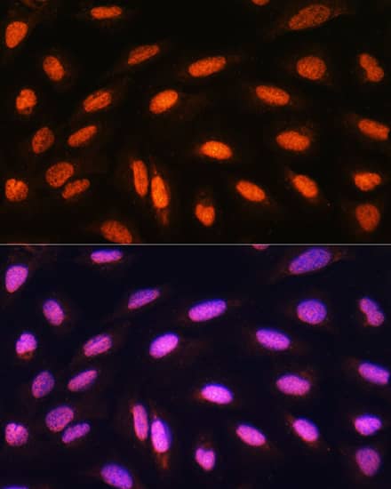 Immunocytochemistry/ Immunofluorescence: PCAF Antibody [NBP3-35063] - Immunofluorescence analysis of U2OS cells using PCAF Rabbit pAb at dilution of 1:100. Secondary antibody: Cy3-conjugated Goat anti-Rabbit IgG (H+L) at 1:500 dilution. Blue: DAPI for nuclear staining.