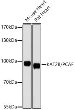 Western Blot: PCAF Antibody [NBP3-35063] - Western blot analysis of various lysates, using PCAF Rabbit pAb at 1:1000 dilution.Secondary antibody: HRP-conjugated Goat anti-Rabbit IgG (H+L) at 1:10000 dilution.Lysates/proteins: 25ug per lane.Blocking buffer: 3% nonfat dry milk in TBST.Detection: ECL Basic Kit.Exposure time: 90s.