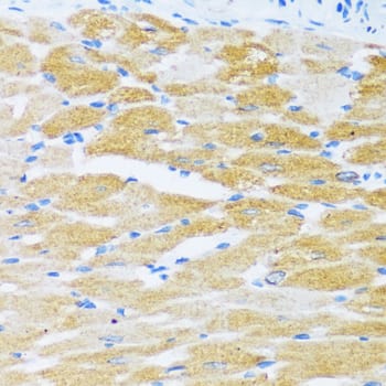 Immunohistochemistry: SERCA2 ATPase Antibody [NBP3-35064] - Immunohistochemistry analysis of paraffin-embedded Rat heart using SERCA2 ATPase Rabbit pAb at dilution of 1:100 (40x lens). Microwave antigen retrieval performed with 0.01M PBS Buffer (pH 7.2) prior to IHC staining.