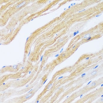 Immunohistochemistry: SERCA2 ATPase Antibody [NBP3-35064] - Immunohistochemistry analysis of paraffin-embedded Mouse heart using SERCA2 ATPase Rabbit pAb at dilution of 1:100 (40x lens). Microwave antigen retrieval performed with 0.01M PBS Buffer (pH 7.2) prior to IHC staining.