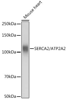 Western Blot: SERCA2 ATPase Antibody [NBP3-35064] - Western blot analysis of lysates from Mouse heart, using SERCA2 ATPase Rabbit pAb at 1:3000 dilution.Secondary antibody: HRP-conjugated Goat anti-Rabbit IgG (H+L) at 1:10000 dilution.Lysates/proteins: 25ug per lane.Blocking buffer: 3% nonfat dry milk in TBST.Detection: ECL Basic Kit.Exposure time: 1s.