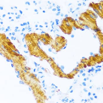 Immunohistochemistry: SERCA2 ATPase Antibody [NBP3-35064] - Immunohistochemistry analysis of paraffin-embedded Mouse lung using SERCA2 ATPase Rabbit pAb at dilution of 1:100 (40x lens). Microwave antigen retrieval performed with 0.01M PBS Buffer (pH 7.2) prior to IHC staining.