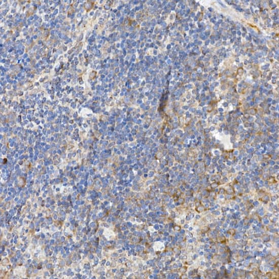 Immunohistochemistry: Caspase-12 Antibody [NBP3-35067] - Immunohistochemistry analysis of paraffin-embedded Mouse spleen using Caspase-12 Rabbit pAb at dilution of 1:100 (40x lens). High pressure antigen retrieval performed with 0.01M Citrate Bufferr (pH 6.0) prior to IHC staining.