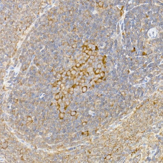 Immunohistochemistry: Caspase-12 Antibody [NBP3-35067] - Immunohistochemistry analysis of paraffin-embedded Rat spleen using Caspase-12 Rabbit pAb at dilution of 1:100 (40x lens). High pressure antigen retrieval performed with 0.01M Citrate Bufferr (pH 6.0) prior to IHC staining.