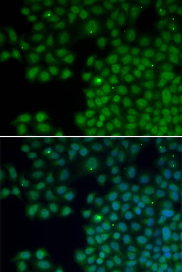 Immunocytochemistry/ Immunofluorescence: NUDT6 Antibody [NBP3-35069] - Immunofluorescence analysis of HeLa cells using NUDT6 Rabbit pAb. Secondary antibody: Cy3-conjugated Goat anti-Rabbit IgG (H+L) at 1:500 dilution. Blue: DAPI for nuclear staining.