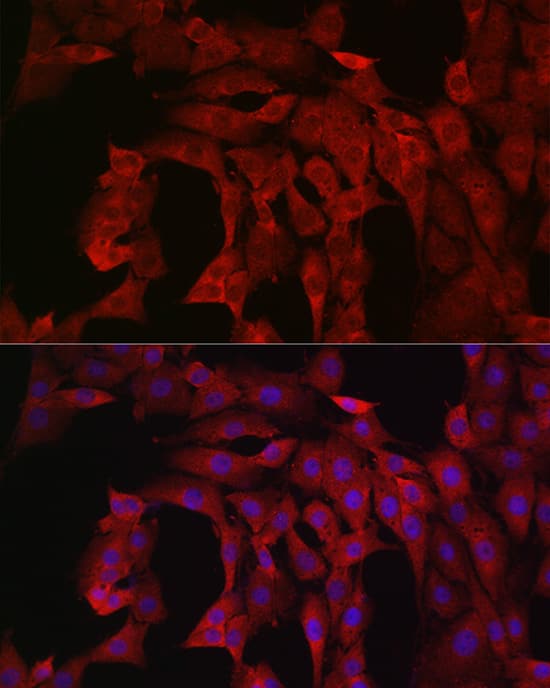 Immunohistochemistry: PIK3CA Antibody [NBP3-35070] - Immunohistochemistry analysis of paraffin-embedded Mouse kidney using PIK3CA Rabbit pAb at dilution of 1:100 (40x lens). High pressure antigen retrieval performed with 0.01M Citrate Bufferr (pH 6.0) prior to IHC staining.