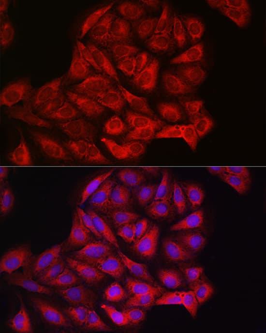 Immunohistochemistry: PIK3CA Antibody [NBP3-35070] - Immunohistochemistry analysis of paraffin-embedded Rat liver using PIK3CA Rabbit pAb at dilution of 1:100 (40x lens). High pressure antigen retrieval performed with 0.01M Citrate Bufferr (pH 6.0) prior to IHC staining.