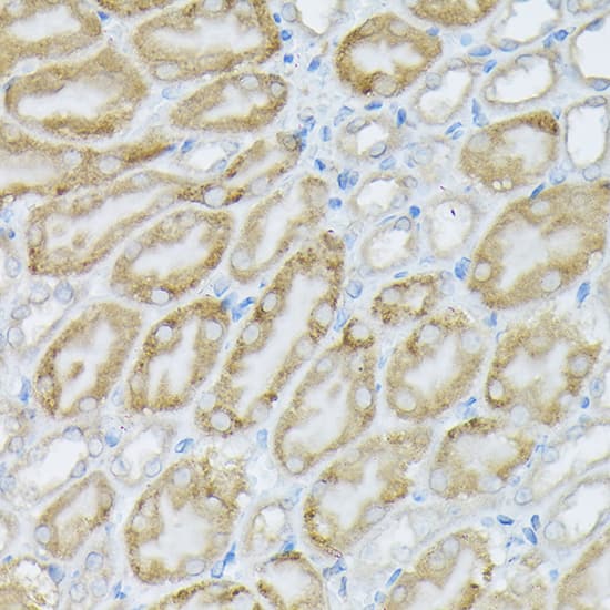 Immunohistochemistry: PIK3CA Antibody [NBP3-35070] - Immunohistochemistry analysis of paraffin-embedded Mouse kidney using PIK3CA Rabbit pAb at dilution of 1:100 (40x lens). High pressure antigen retrieval performed with 0.01M Citrate Bufferr (pH 6.0) prior to IHC staining.