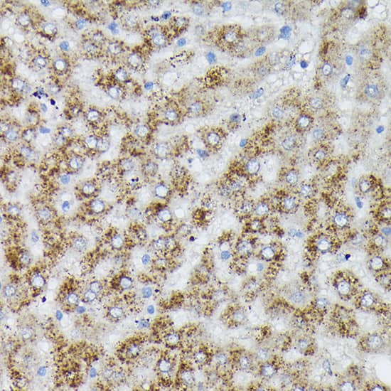 Immunohistochemistry: PIK3CA Antibody [NBP3-35070] - Immunohistochemistry analysis of paraffin-embedded Rat liver using PIK3CA Rabbit pAb at dilution of 1:100 (40x lens). High pressure antigen retrieval performed with 0.01M Citrate Bufferr (pH 6.0) prior to IHC staining.