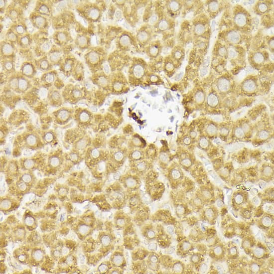 Immunohistochemistry: PIK3CA Antibody [NBP3-35070] - Immunohistochemistry analysis of paraffin-embedded Rat liver using PIK3CA Rabbit pAb at dilution of 1:100 (40x lens). High pressure antigen retrieval performed with 0.01M Citrate Bufferr (pH 6.0) prior to IHC staining.