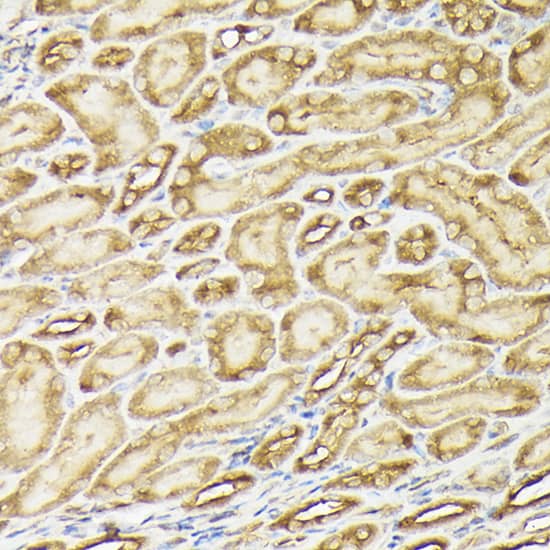 Immunohistochemistry: PIK3CA Antibody [NBP3-35070] - Immunohistochemistry analysis of paraffin-embedded Mouse kidney using PIK3CA Rabbit pAb at dilution of 1:100 (40x lens). High pressure antigen retrieval performed with 0.01M Citrate Bufferr (pH 6.0) prior to IHC staining.