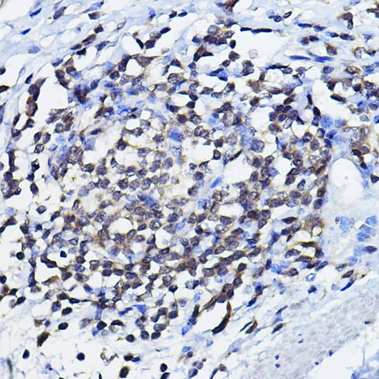 Immunohistochemistry: p73 Antibody [NBP3-35073] - Immunohistochemistry analysis of paraffin-embedded Human lymph node using p73 Rabbit pAb at dilution of 1:100 (40x lens). High pressure antigen retrieval performed with 0.01M Citrate Bufferr (pH 6.0) prior to IHC staining.