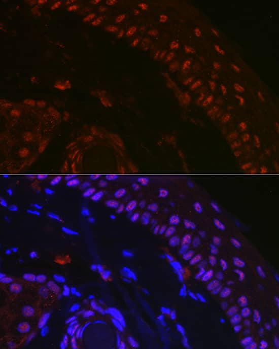 Immunocytochemistry/ Immunofluorescence: p73 Antibody [NBP3-35073] - Immunofluorescence analysis of paraffin-embedded mouse skin using p73 Rabbit pAb at dilution of 1:100 (40x lens). Secondary antibody: Cy3-conjugated Goat anti-Rabbit IgG (H+L) at 1:500 dilution. Blue: DAPI for nuclear staining.