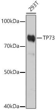 Western Blot: p73 Antibody [NBP3-35073] - Western blot analysis of lysates from 293T cells, using p73 Rabbit pAb at 1:1000 dilution.Secondary antibody: HRP-conjugated Goat anti-Rabbit IgG (H+L) at 1:10000 dilution.Lysates/proteins: 25ug per lane.Blocking buffer: 3% nonfat dry milk in TBST.Detection: ECL Basic Kit.Exposure time: 180s.