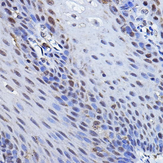 Immunohistochemistry: p73 Antibody [NBP3-35073] - Immunohistochemistry analysis of paraffin-embedded Human esophageal using p73 Rabbit pAb at dilution of 1:100 (40x lens). High pressure antigen retrieval performed with 0.01M Citrate Bufferr (pH 6.0) prior to IHC staining.