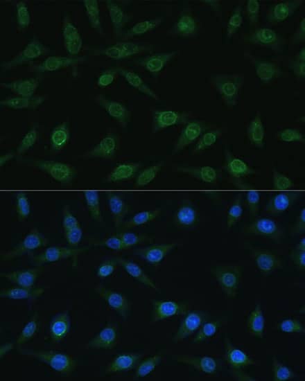 Immunocytochemistry/ Immunofluorescence: NUP98 Antibody [NBP3-35075] - Immunofluorescence analysis of L929 cells using NUP98 Rabbit pAb at dilution of 1:100. Blue: DAPI for nuclear staining.