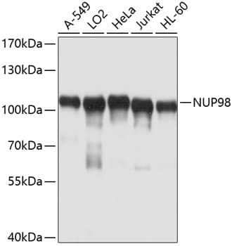 Western Blot: NUP98 Antibody [NBP3-35075] - Western blot analysis of various lysates using NUP98 Rabbit pAb at 1:1000 dilution.Secondary antibody: HRP-conjugated Goat anti-Rabbit IgG (H+L) at 1:10000 dilution.Lysates/proteins: 25ug per lane.Blocking buffer: 3% nonfat dry milk in TBST.Detection: ECL Basic Kit.Exposure time: 5s.