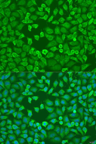 Immunocytochemistry/ Immunofluorescence: EIF3A Antibody [NBP3-35076] - Immunofluorescence analysis of U2OS cells using EIF3A Rabbit pAb at dilution of 1:100. Secondary antibody: Cy3-conjugated Goat anti-Rabbit IgG (H+L) at 1:500 dilution. Blue: DAPI for nuclear staining.