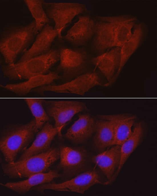 Immunocytochemistry/ Immunofluorescence: Myosin Phosphatase Antibody [NBP3-35077] - Immunofluorescence analysis of U2OS cells using Myosin Phosphatase Rabbit pAb at dilution of 1:100 (40x lens). Secondary antibody: Cy3-conjugated Goat anti-Rabbit IgG (H+L) at 1:500 dilution. Blue: DAPI for nuclear staining.