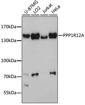 Western Blot: Myosin Phosphatase Antibody [NBP3-35077] - Western blot analysis of various lysates using Myosin Phosphatase Rabbit pAb at 1:3000 dilution.Secondary antibody: HRP-conjugated Goat anti-Rabbit IgG (H+L) at 1:10000 dilution.Lysates/proteins: 25ug per lane.Blocking buffer: 3% nonfat dry milk in TBST.Detection: ECL Basic Kit.Exposure time: 90s.