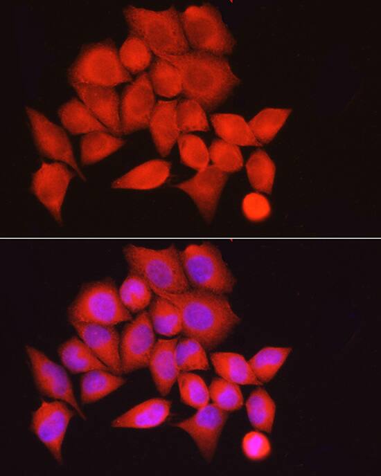 Immunocytochemistry/ Immunofluorescence Myosin Phosphatase Antibody