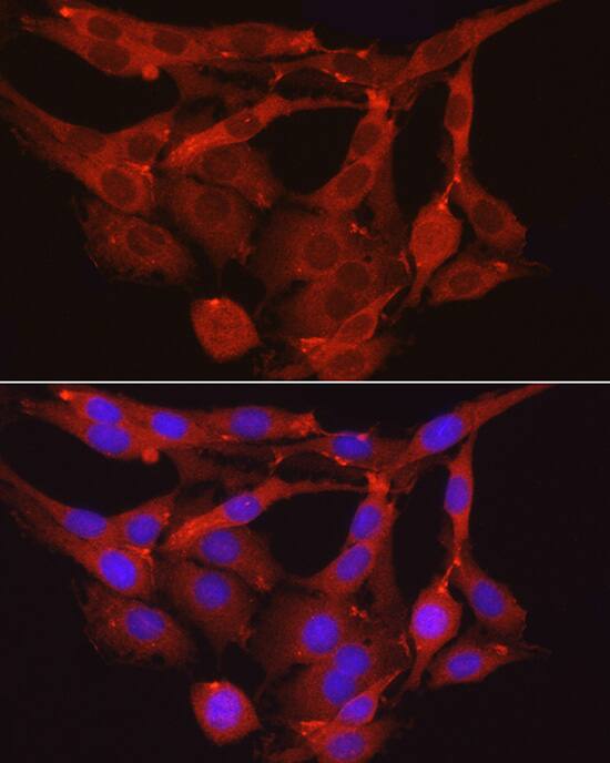 Immunocytochemistry/ Immunofluorescence Myosin Phosphatase Antibody