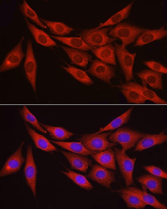 Immunocytochemistry/ Immunofluorescence: Myosin Phosphatase Antibody [NBP3-35077] - Immunofluorescence analysis of NIH/3T3 cells using Myosin Phosphatase Rabbit pAb at dilution of 1:100 (40x lens). Secondary antibody: Cy3-conjugated Goat anti-Rabbit IgG (H+L) at 1:500 dilution. Blue: DAPI for nuclear staining.