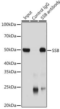 Immunoprecipitation: SSB Antibody [NBP3-35080] - Immunoprecipitation analysis of 200 ug extracts of Jurkat cells using 3 ug SSB antibody. Western blot was performed from the immunoprecipitate using SSB antibody at a dilution of 1:1000.