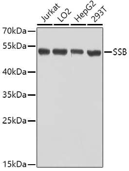 Western Blot: SSB Antibody [NBP3-35080] - Western blot analysis of various lysates using SSB Rabbit pAb at 1:1000 dilution.Secondary antibody: HRP-conjugated Goat anti-Rabbit IgG (H+L) at 1:10000 dilution.Lysates/proteins: 25ug per lane.Blocking buffer: 3% nonfat dry milk in TBST.Detection: ECL Basic Kit.Exposure time: 1s.