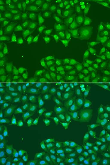 Immunocytochemistry/ Immunofluorescence: SSB Antibody [NBP3-35080] - Immunofluorescence analysis of U2OS cells using SSB Rabbit pAb at dilution of 1:100. Secondary antibody: Cy3-conjugated Goat anti-Rabbit IgG (H+L) at 1:500 dilution. Blue: DAPI for nuclear staining.